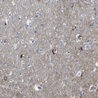Anti-HK1 Antibody