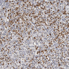 Anti-PRR12 Antibody