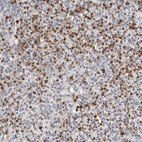 Anti-PRR12 Antibody
