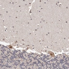 Immunohistochemical staining of human cerebellum shows moderate nuclear positivity in Purkinje cells.