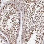 Immunohistochemical staining of human testis shows moderate nuclear positivity in cells in seminiferous ducts.