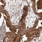 Immunohistochemical staining of human placenta shows strong nuclear and cytoplasmic positivity in trophoblastic cells.