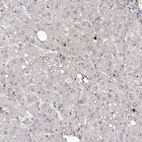Immunohistochemical staining of human liver shows no positivity in hepatocytes as expected.