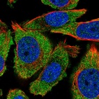 Immunofluorescent staining of human cell line PC-3 shows localization to cytosol.