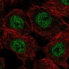 Immunofluorescent staining of human cell line MCF7 shows localization to nucleoplasm.
