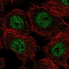 Immunofluorescent staining of human cell line MCF7 shows localization to nucleoplasm.