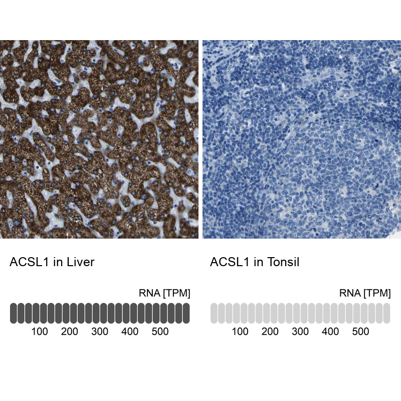 Anti-ACSL1 Antibody
