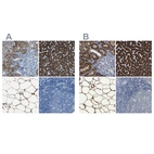 Immunohistochemical staining of human kidney, liver, soft tissues and tonsil using Anti-ACSL1 antibody HPA011964 (A) shows similar protein distribution across tissues to independent antibody HPA011316 (B).
