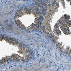 Immunohistochemical staining of human prostate shows moderate granular cytoplasmic positivity in glandular cells.