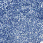 Immunohistochemical staining of human tonsil shows no cytoplasmic positivity in germinal center cells as expected.
