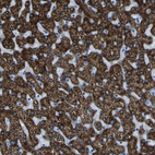 Immunohistochemical staining of human liver shows strong granular cytoplasmic positivity in hepatocytes.