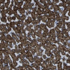 Immunohistochemical staining of human liver shows strong granular cytoplasmic positivity in hepatocytes.