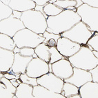 Immunohistochemical staining of human soft tissues shows moderate to strong cytoplasmic positivity in adipocytes.