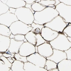 Immunohistochemical staining of human soft tissues shows moderate to strong cytoplasmic positivity in adipocytes.