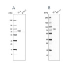 Western blot analysis using Anti-ACSL1 antibody HPA011964 (A) shows similar pattern to independent antibody HPA011316 (B).