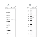 Western blot analysis using Anti-ACSL1 antibody HPA011964 (A) shows similar pattern to independent antibody HPA011316 (B).