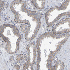 Immunohistochemical staining of human prostate shows weak granular cytoplasmic positivity in glandular cells.