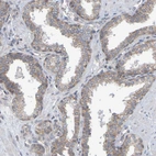 Immunohistochemical staining of human prostate shows weak granular cytoplasmic positivity in glandular cells.
