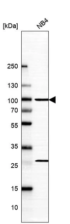 Western blot analysis in human cell line NB4.