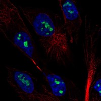 Anti-MAGEH1 Antibody