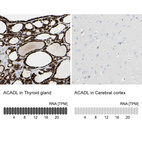 Anti-ACADL Antibody