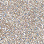 Anti-ACADL Antibody