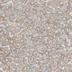 Immunohistochemical staining of human liver shows moderate cytoplasmic positivity in hepatocytes.