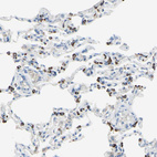 Immunohistochemical staining of human lung shows moderate to strong granular cytoplasmic positivity in macrophages.