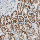 Immunohistochemical staining of human kidney shows moderate granular cytoplasmic positivity in cells in tubules.