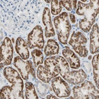 Immunohistochemical staining of human kidney shows moderate granular cytoplasmic positivity in cells in tubules.