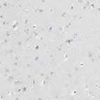 Immunohistochemical staining of human cerebral cortex shows no positivity as expected.