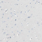 Immunohistochemical staining of human cerebral cortex shows no positivity as expected.