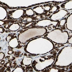 Immunohistochemical staining of human thyroid gland shows strong cytoplasmic positivity in glandular cells.
