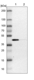 Anti-ACADL Antibody