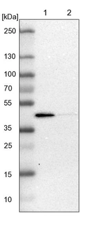Lane 1: NIH-3T3 cell lysate (Mouse embryonic fibroblast cells)_br/_Lane 2: NBT-II cell lysate (Rat Wistar bladder tumour cells)