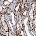 Anti-MGLL Antibody