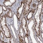 Immunohistochemical staining of human kidney shows cytoplasmic positivity in cells in tubules.