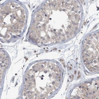 Immunohistochemical staining of human testis shows cytoplasmic positivity in cells in seminiferous ducts and Leydig cells.