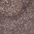 Immunohistochemical staining of human tonsil shows strong nuclear positivity in lymphoid cells.