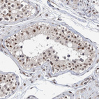 Immunohistochemical staining of human testis shows moderate nuclear positivity in cells in seminiferous ducts.