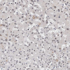 Anti-CHD4 Antibody