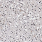 Immunohistochemical staining of human liver shows weak positivity in hepatocytes as expected.