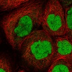 Immunofluorescent staining of human cell line A-431 shows localization to nucleoplasm.