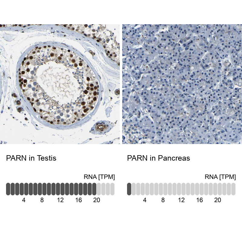 Anti-PARN Antibody