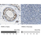 Anti-PARN Antibody