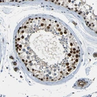 Immunohistochemical staining of human testis shows high expression.