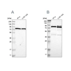 Western blot analysis using Anti-PARN antibody HPA012010 (A) shows similar pattern to independent antibody HPA006314 (B).