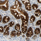 Immunohistochemical staining of human duodenum shows strong cytoplasmic and membranous positivity in glandular cells.