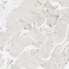 Immunohistochemical staining of human skeletal muscle shows no positivity in myocytes as expected.
