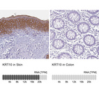 Anti-KRT10 Antibody